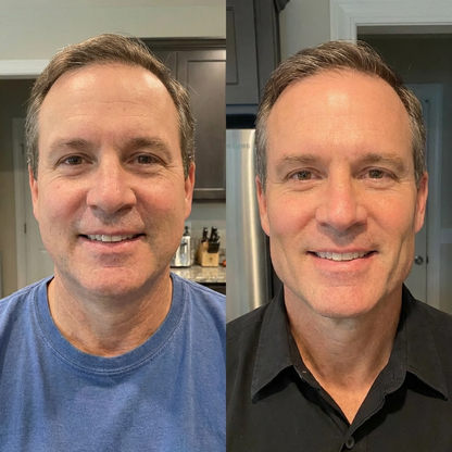 Suvelta Collagen Face Sculpting Wrap