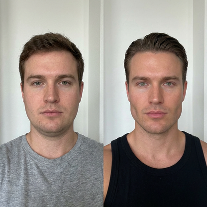 Suvelta Collagen Face Sculpting Wrap